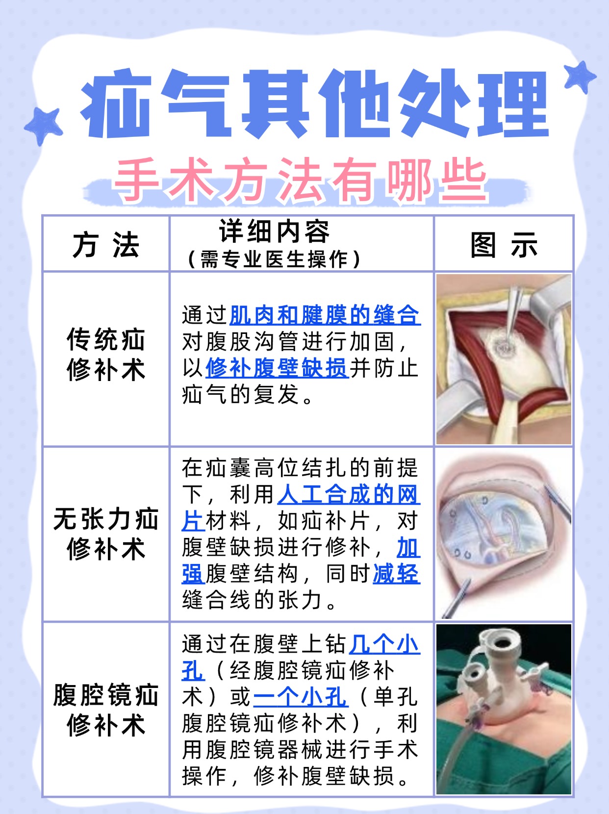 疝气最新疗法，科技重塑生活品质，助力患者康复之路